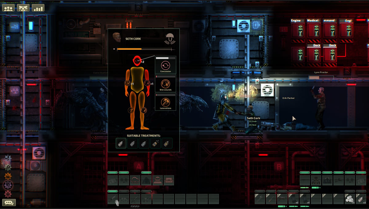 Barotrauma thumbnail 6